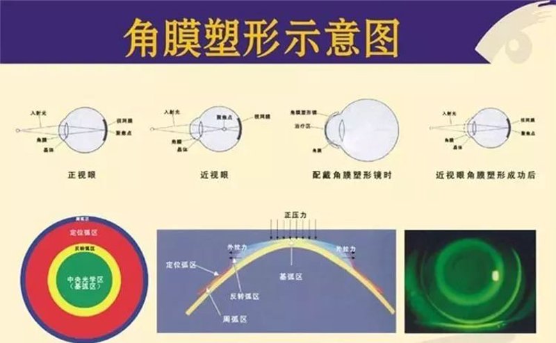 专业验光师：守护你眼中世界的专业使者
