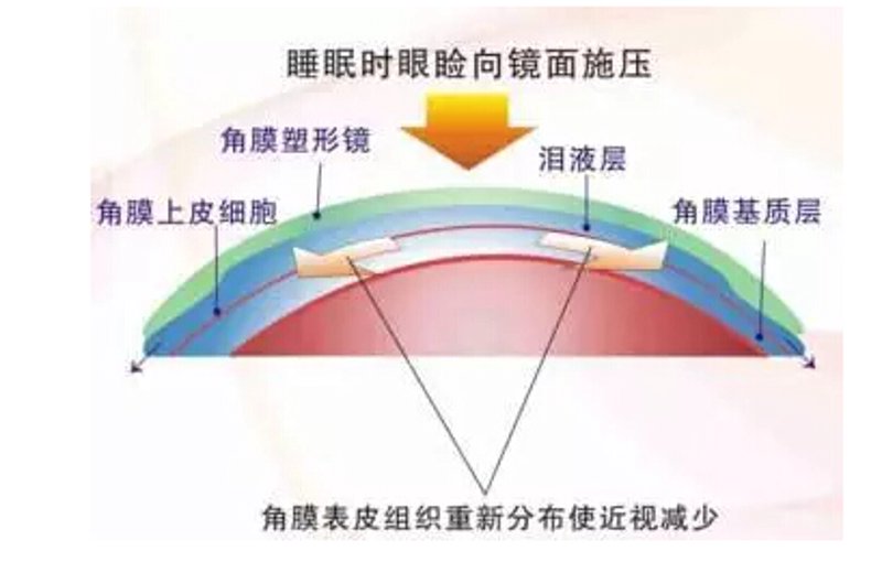 专业验光师：守护你眼中世界的专业使者